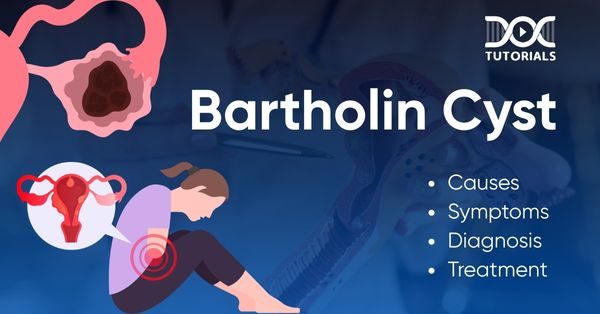 Bartholin
