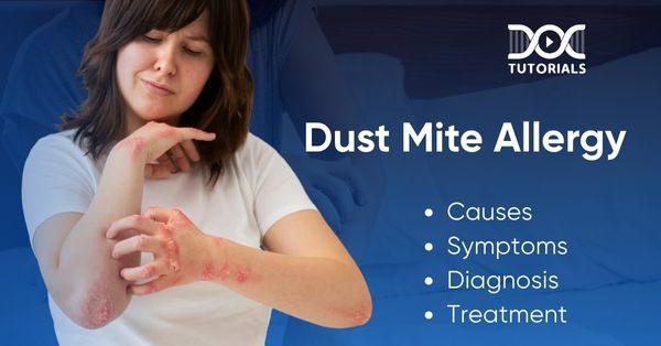 Dust Mite