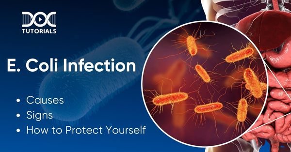 E Coli Infection