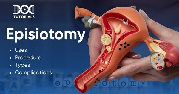 Episiotomy