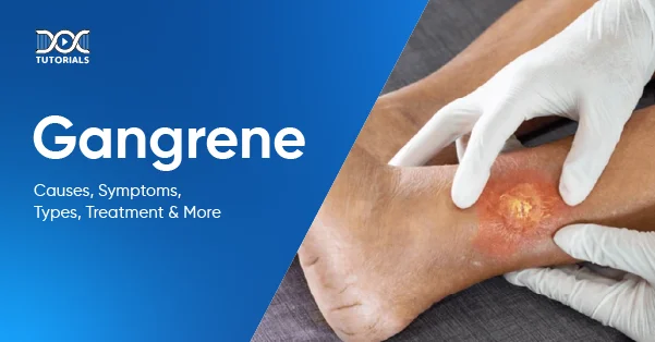 Gangrene