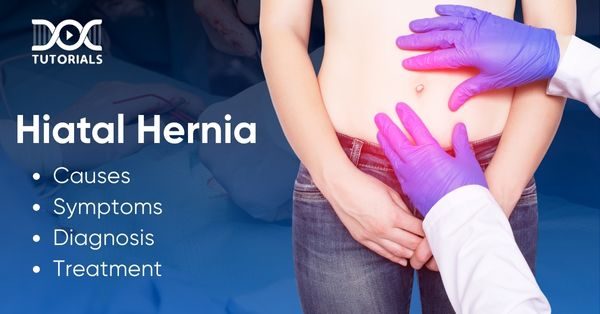 Hiatal Hernia
