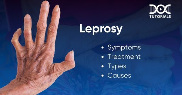 Leprosy