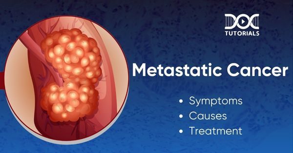 Metastatic Cancer