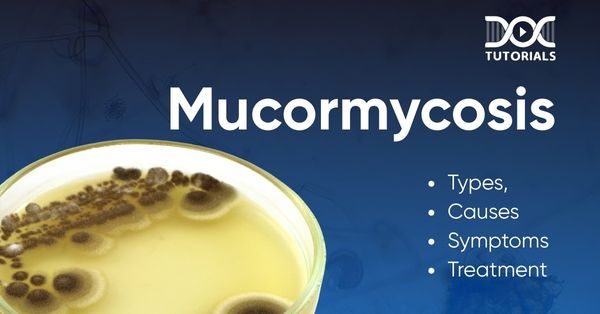 Mucormycosis