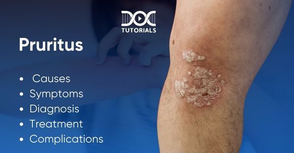 Pruritus