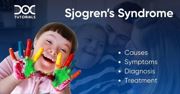 Sjogrens