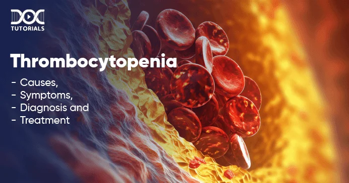 Thrombocytopenia