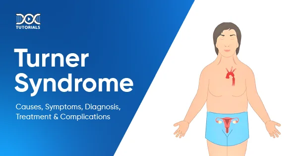 Turner Syndrome