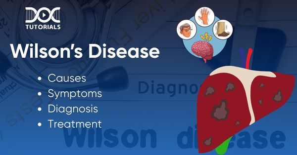 Wilsons disease
