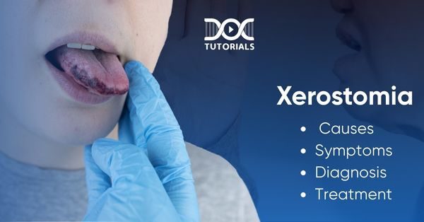 Xerostomia