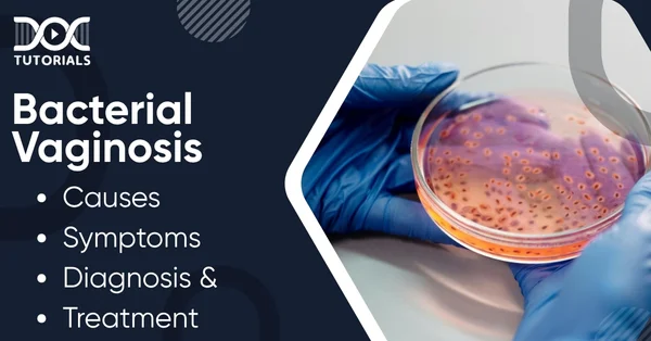Bacterial Vaginosis