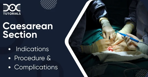 Caesarean Section