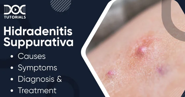 Hidradenitis
