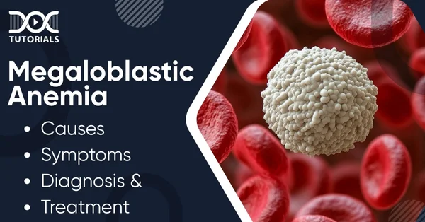 Megaloblastic Anaemia
