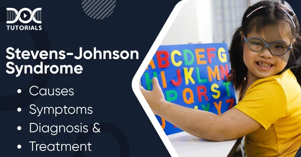 Stevens-Johnson Syndrome