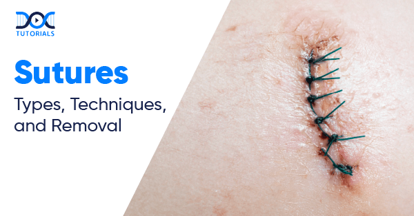 Sutures