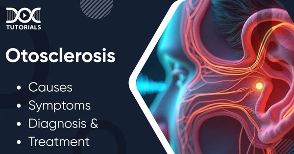 Otosclerosis