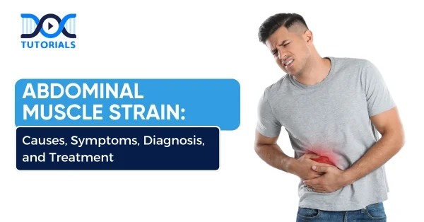 Abdominal-muscle-Strain