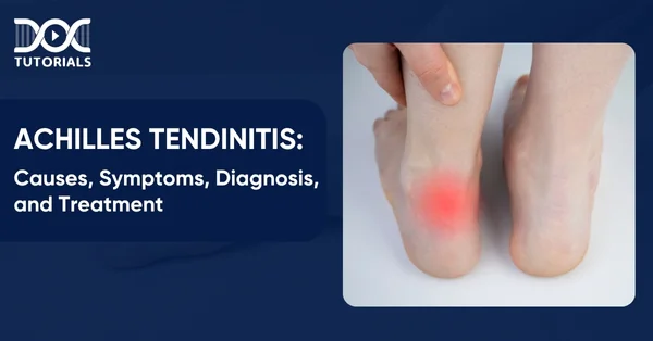 Achilles Tendinitis
