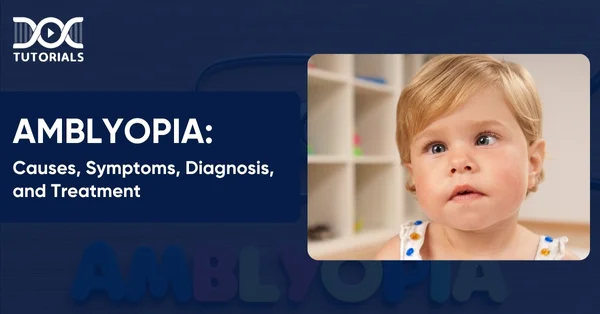 Amblyopia