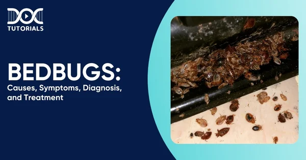 Bedbugs