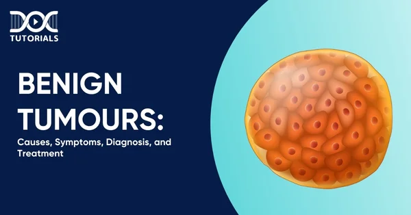 Benign Tumours