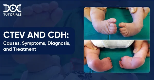 CTEV and CDH