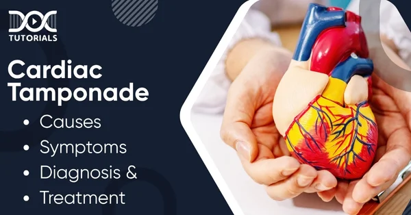 Cardiac Tamponade
