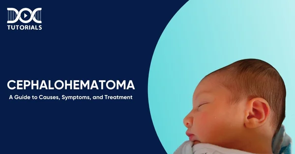 Cephalohematoma