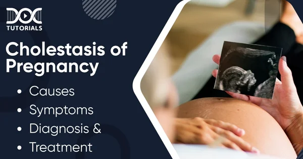 Cholestasis