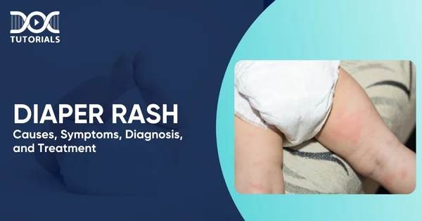 Diaper Rash