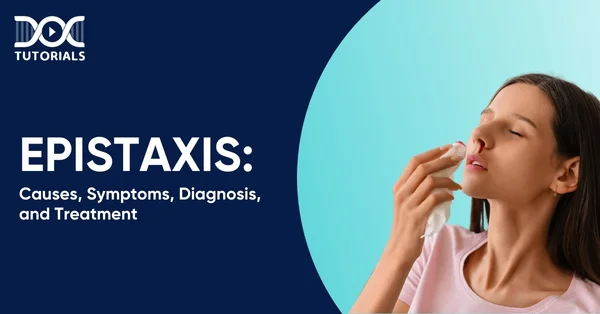Epistaxis