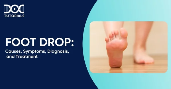 Foot Drop