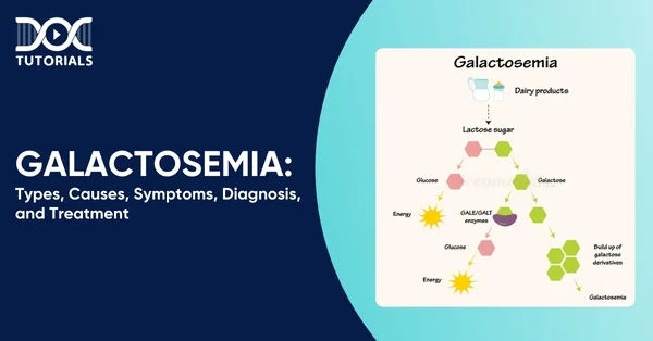 Galactosemia
