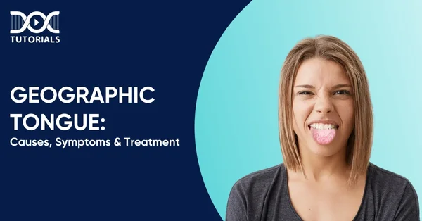 Geographic Tongue