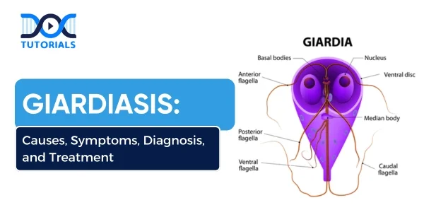 Giardiasis