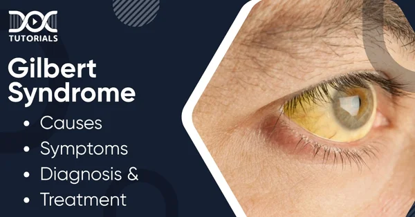 Gilbert Syndrome