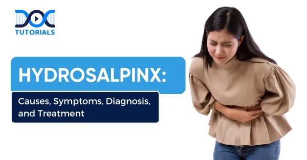 Hydrosalpinx