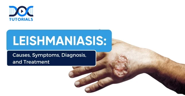 Leishmaniasis