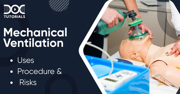 Mechanical Ventilation