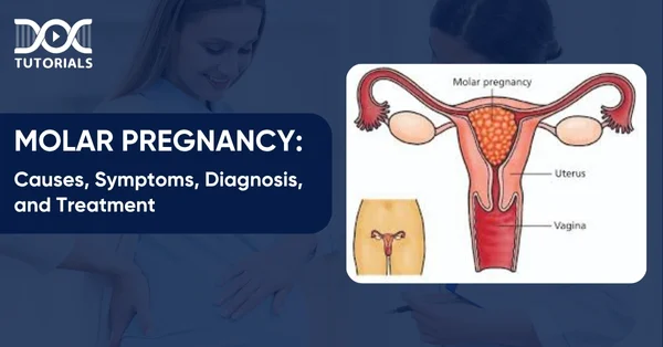 Molar Pregnancy