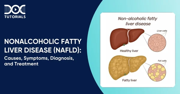 NAFLD