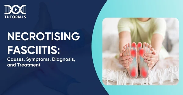 Necrotising Fasciitis