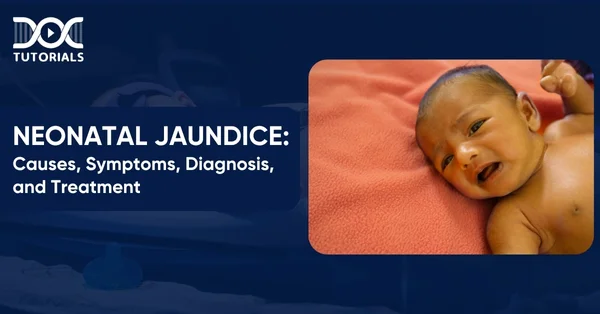 Neonatal Jaundice