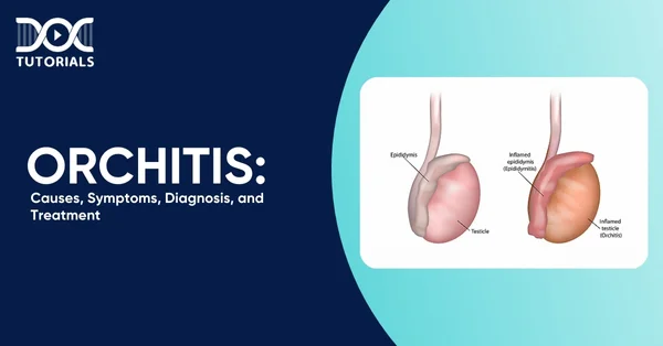 Orchitis