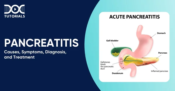 Pancreatitis