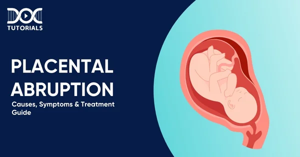 Placental Abruption