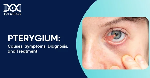 Pterygium