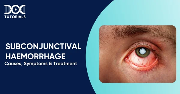 Subconjunctival